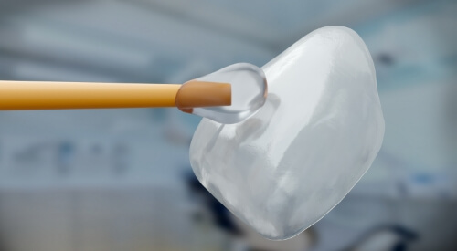 Close up of dental adhesive being applied to a veneer