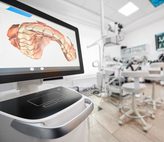 Digital model of teeth on computer monitor in dental office