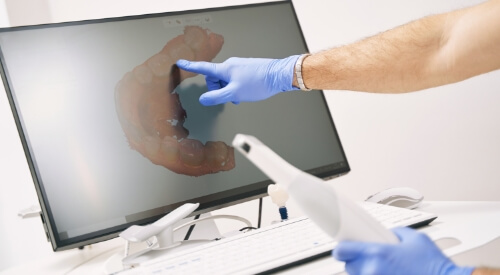 Dentist pointing to computer screen showing digital impressions of teeth