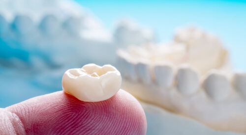 Dental crown resting on a finger