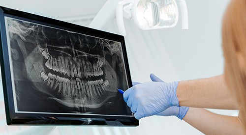 There are several types of treatment available for TMJ disorders depending on the cause of your specific condition